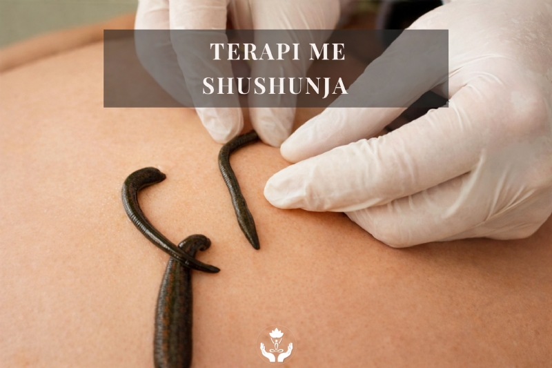 Terapi me shushunja, terapi me shushunja Tirana, hirudoterapi, hirudoterapi Tirana, terapi shushunja profesionale, trajtim me shushunja, trajtim me shushunja Tirana, leech therapy, leech therapy Tirana, hirudotherapy, hirudotherapy Tirana